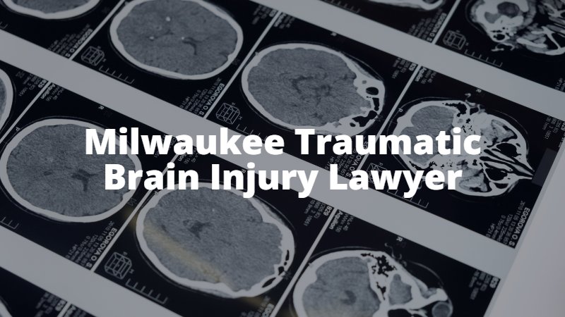 Milwaukee Traumatic Brain Injury Attorney